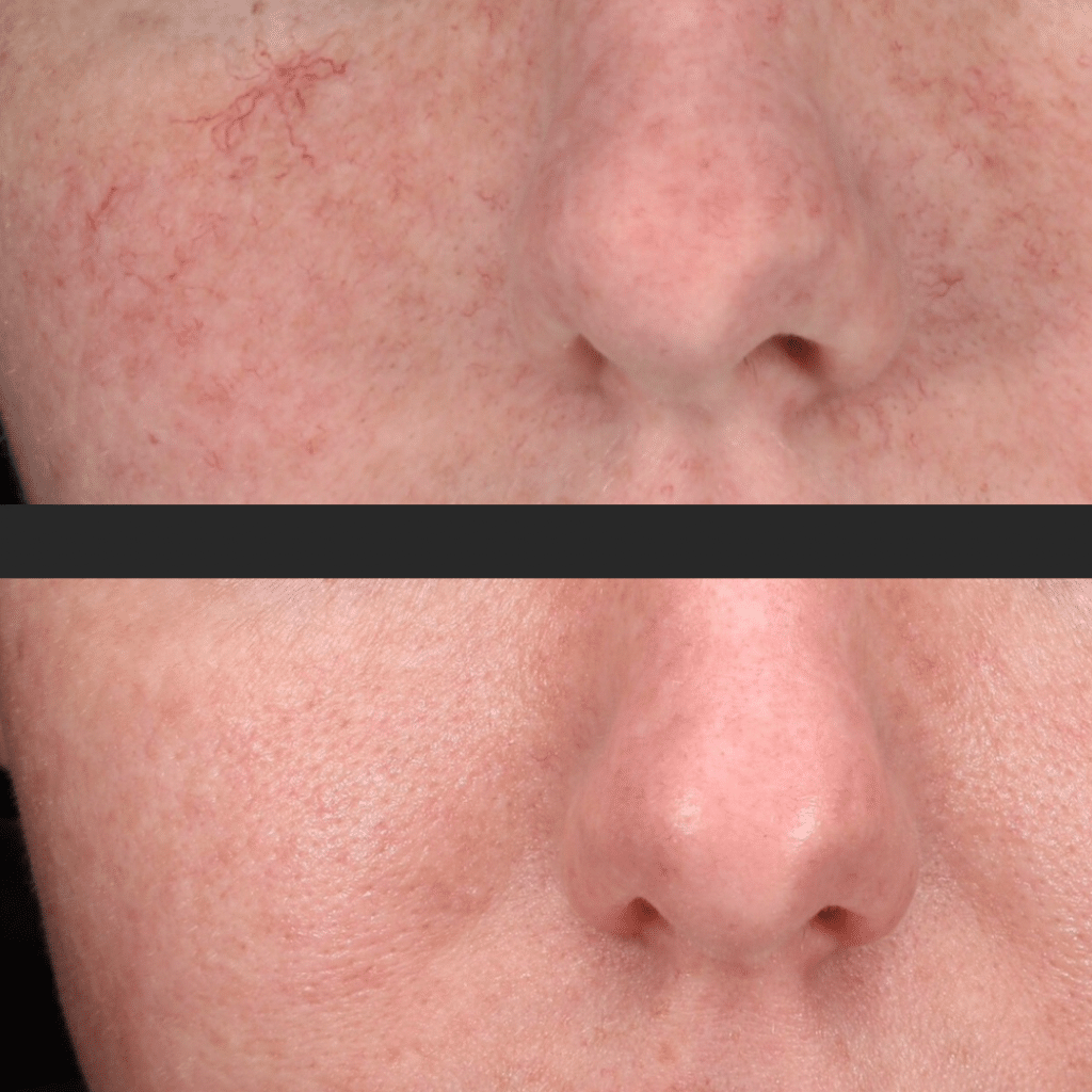 Before and After Image: Black and White Lash Tech - front