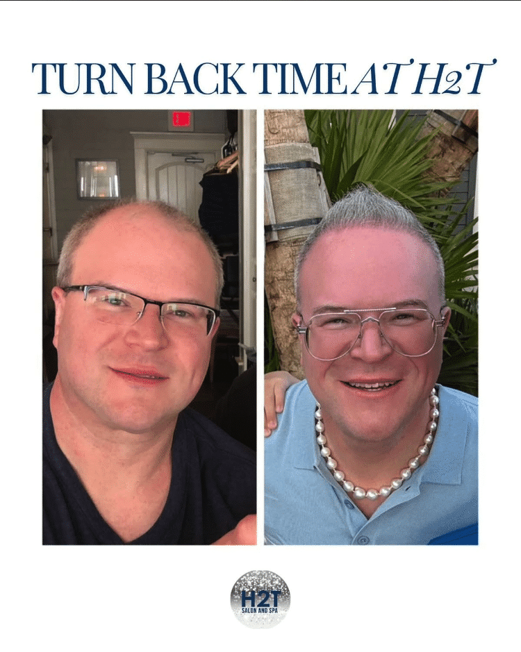 Before and After Image: Turn Back Time - front